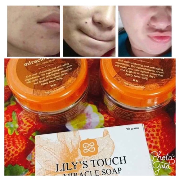Lily’s Touch Other - Lily Touch Miracle Cream Anti-Acne Aging Benefits